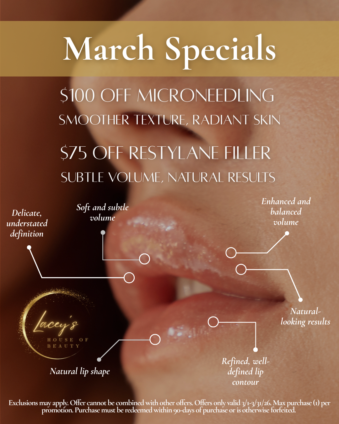 $75 OFF Restylane Filler